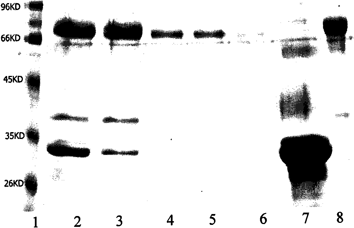 Anti-osteopontin OPN monoclonal antibody and application thereof