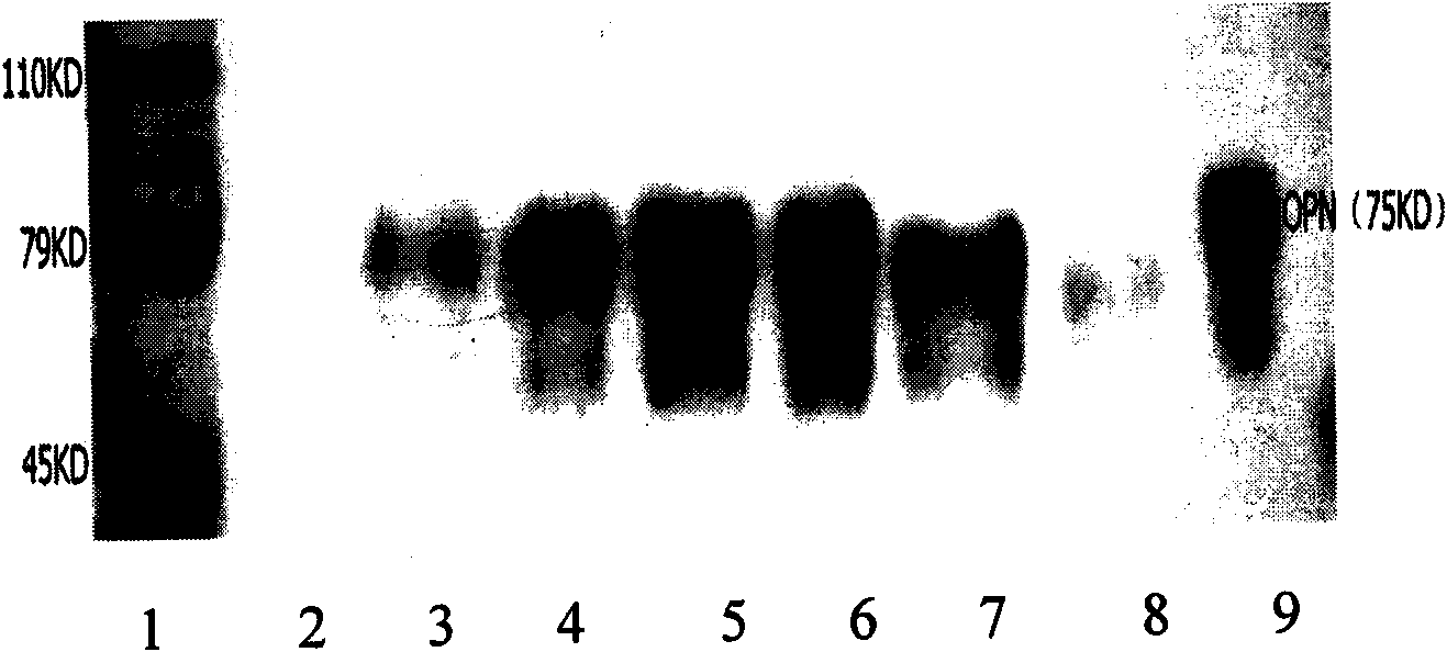 Anti-osteopontin OPN monoclonal antibody and application thereof