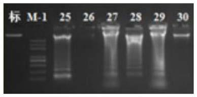 Application of reagent for detecting flora in preparation of reagent or kit for prognosis prediction markers of esophageal squamous cell carcinoma patients