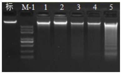 Application of reagent for detecting flora in preparation of reagent or kit for prognosis prediction markers of esophageal squamous cell carcinoma patients