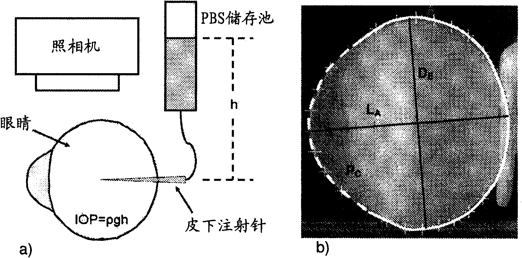 Photochemical therapy to affect mechanical and/or chemical properties of body tissue