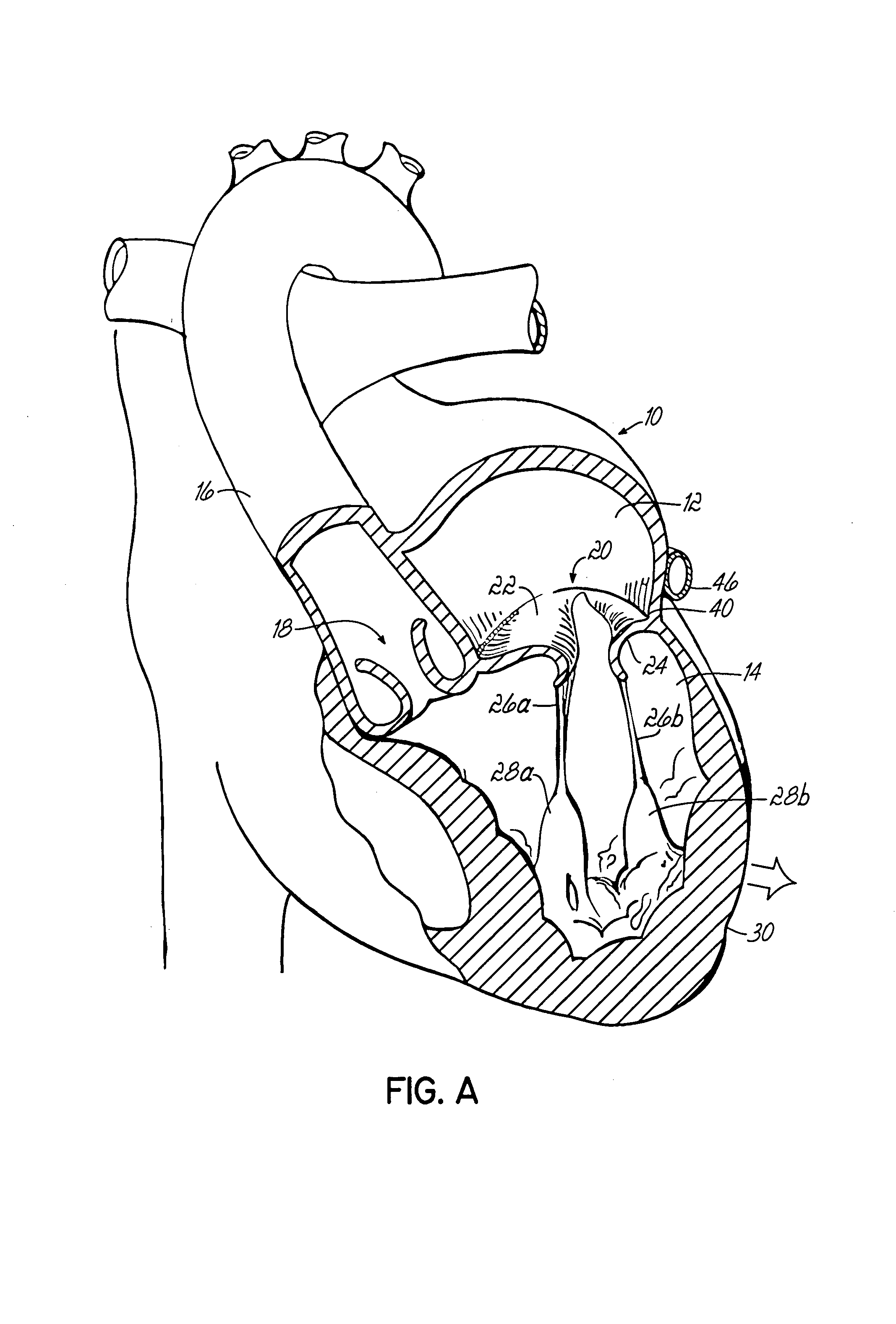 Tissue fastening systems and methods utilizing magnetic guidance