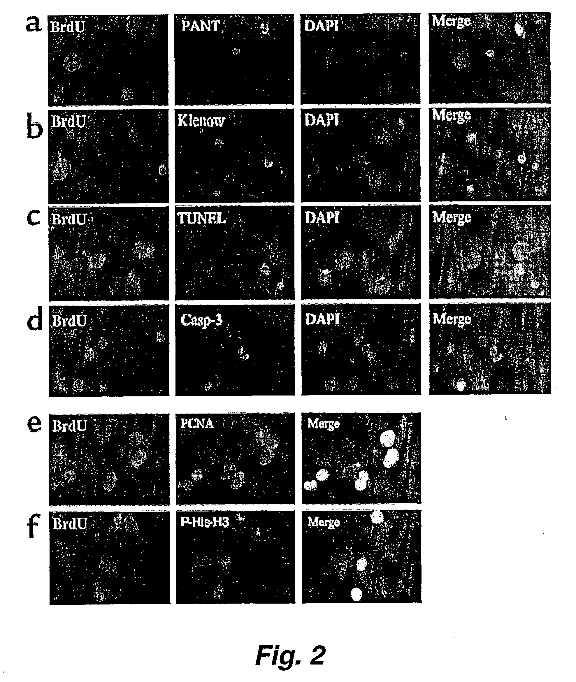 Neurogenerative or neurotrophic factors for mitigating a symptom of ischemia