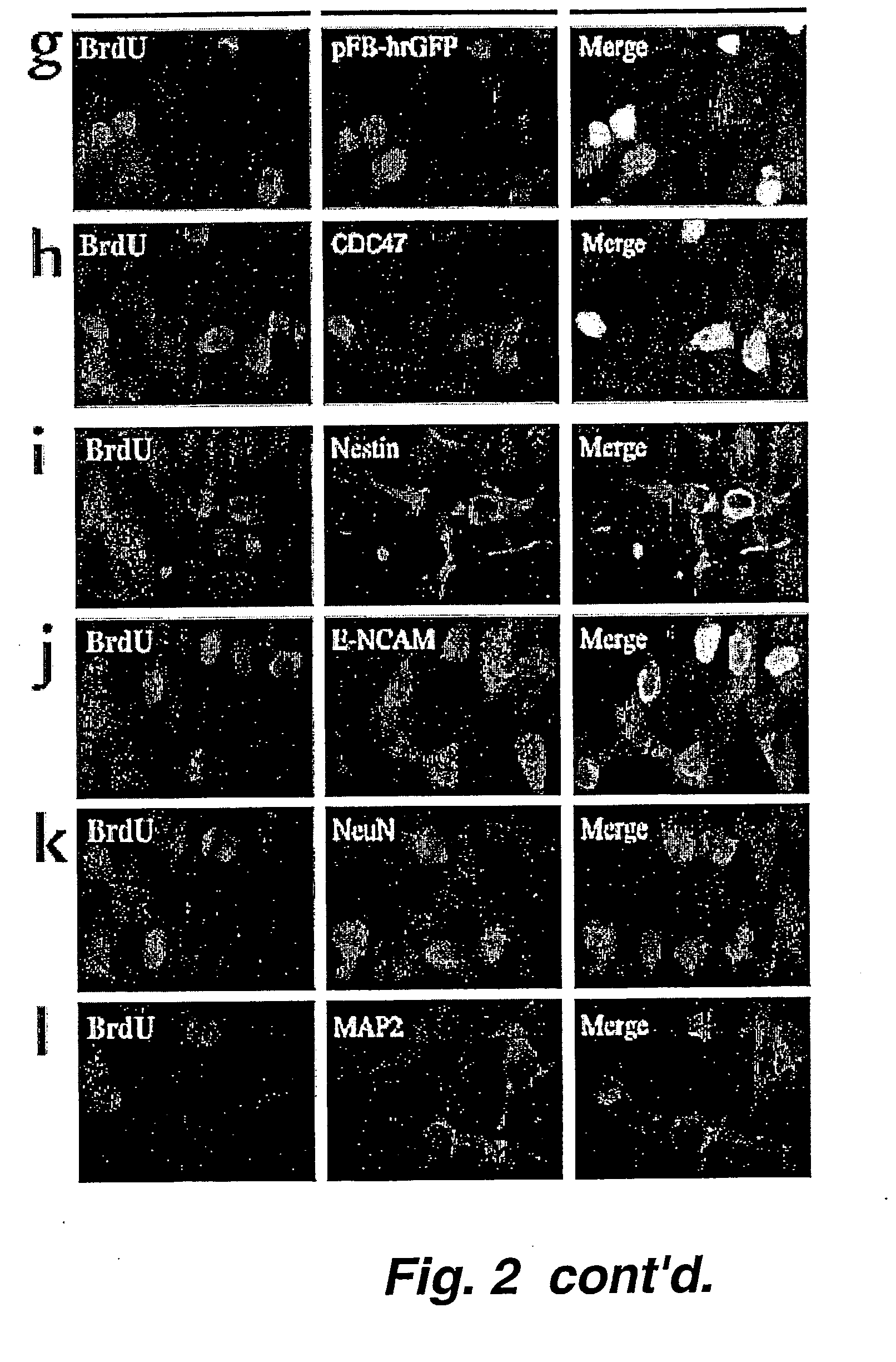 Neurogenerative or neurotrophic factors for mitigating a symptom of ischemia