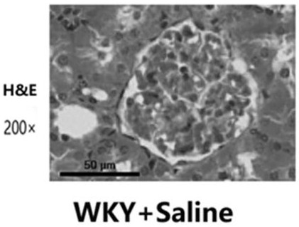 Application of Wulan thirteen-ingredient decoction powder in preparation of medicine for protecting renal injury caused by primary hypertension