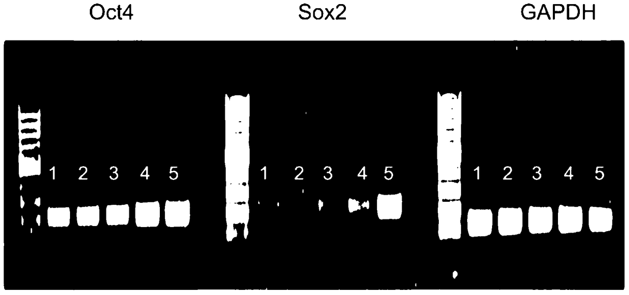 A kind of dendritic cell vaccine and its preparation method and application