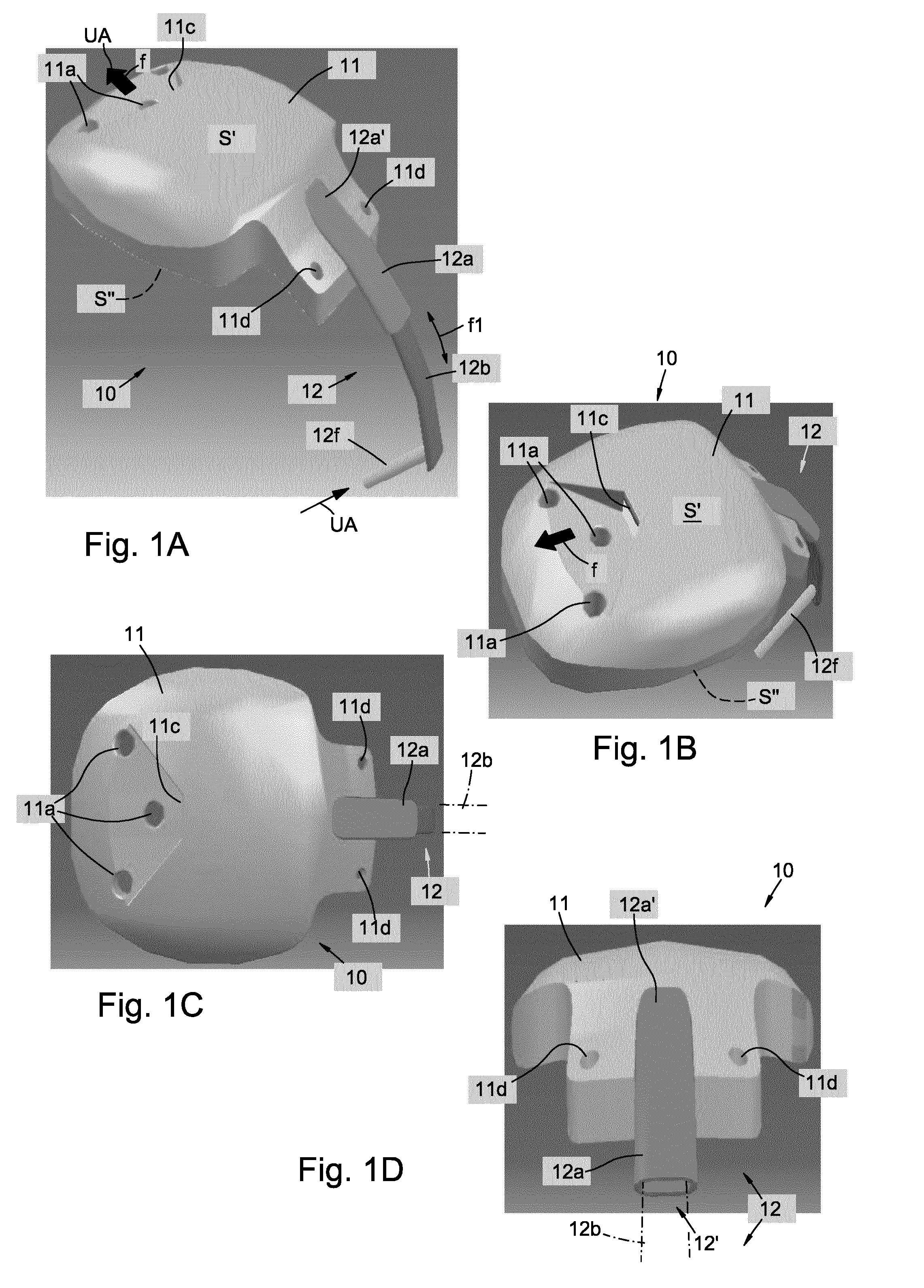 Drain valve implantable in the eye of a patient for the treatment of glaucoma