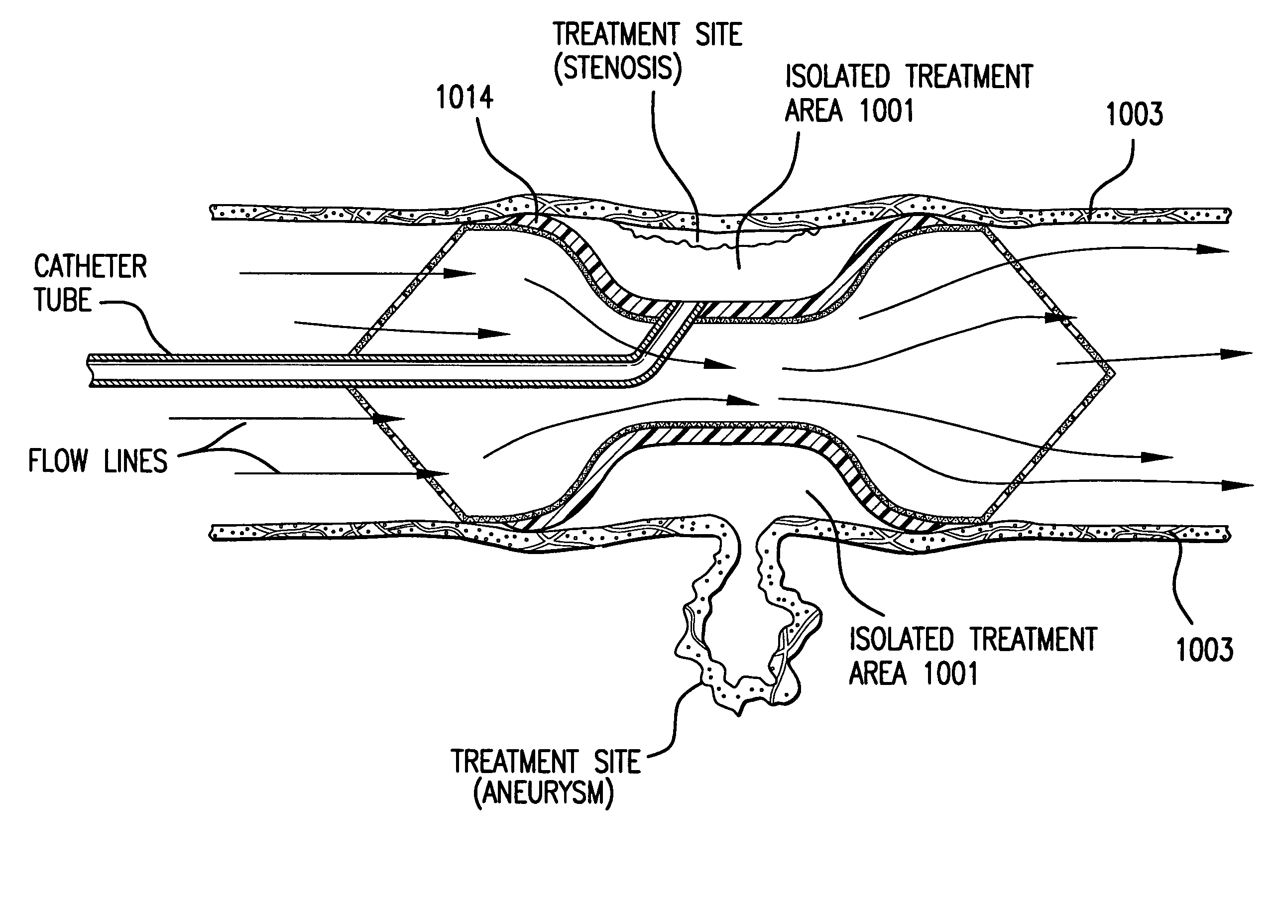 Vessel isolation device