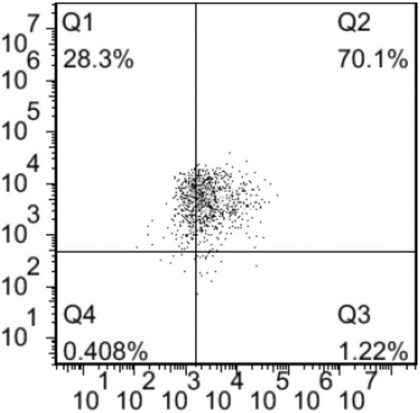 CD22-targeted high-lethality chimeric antigen receptor T-cell and use thereof in preparation of drugs for treating tumors