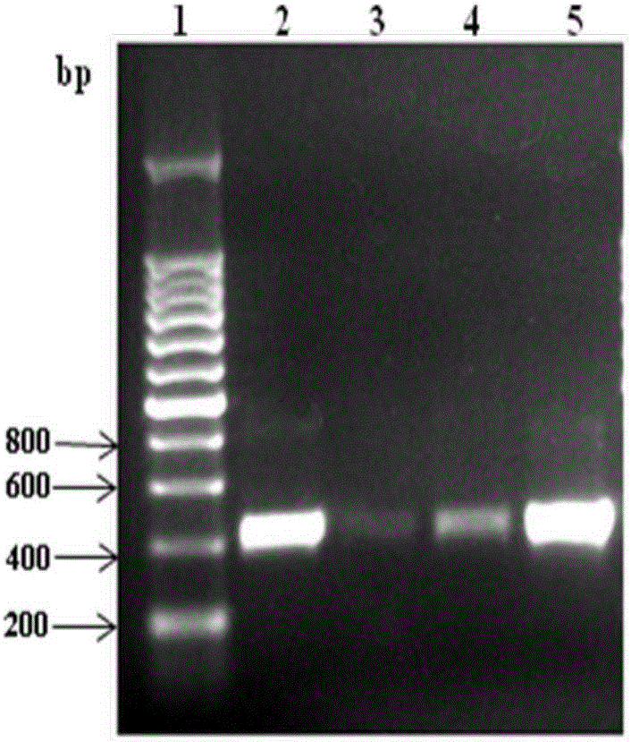 Anti-human C-reactive protein antibody and application thereof