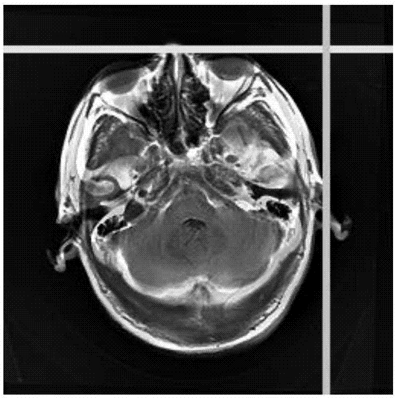 Wavelet-transform-based multi-modal medical image fusion method