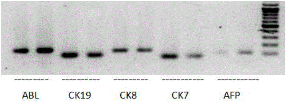 Adult human hepatogenic stem cell line HN, preparation method thereof and application