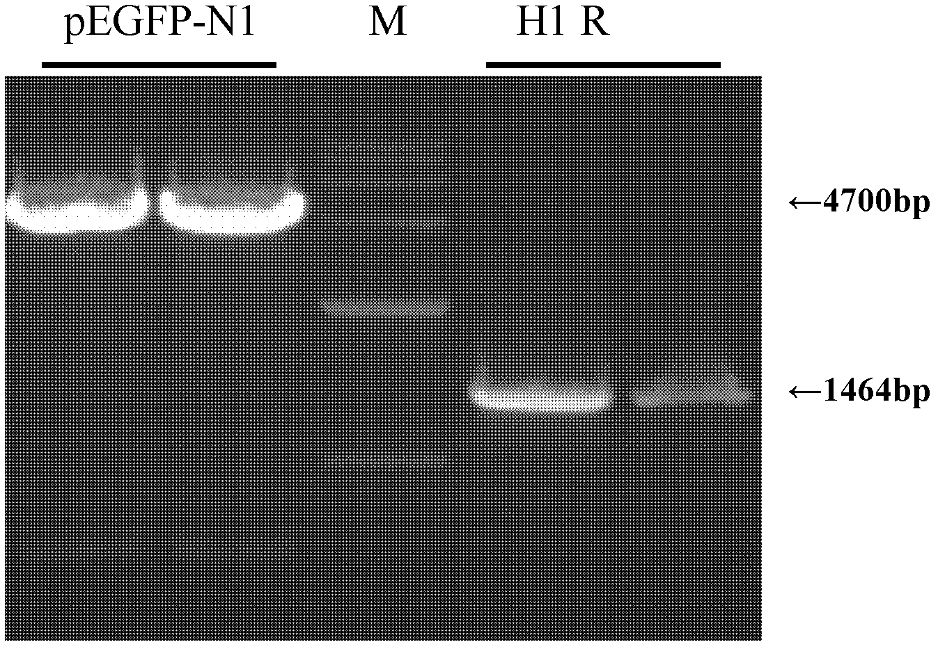 Construction method of recombinant HEK (human embryonic kidney) 293 cells highly expressing H1R (histamine receptor 1)