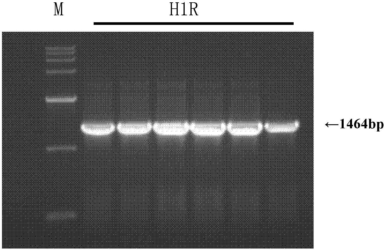 Construction method of recombinant HEK (human embryonic kidney) 293 cells highly expressing H1R (histamine receptor 1)