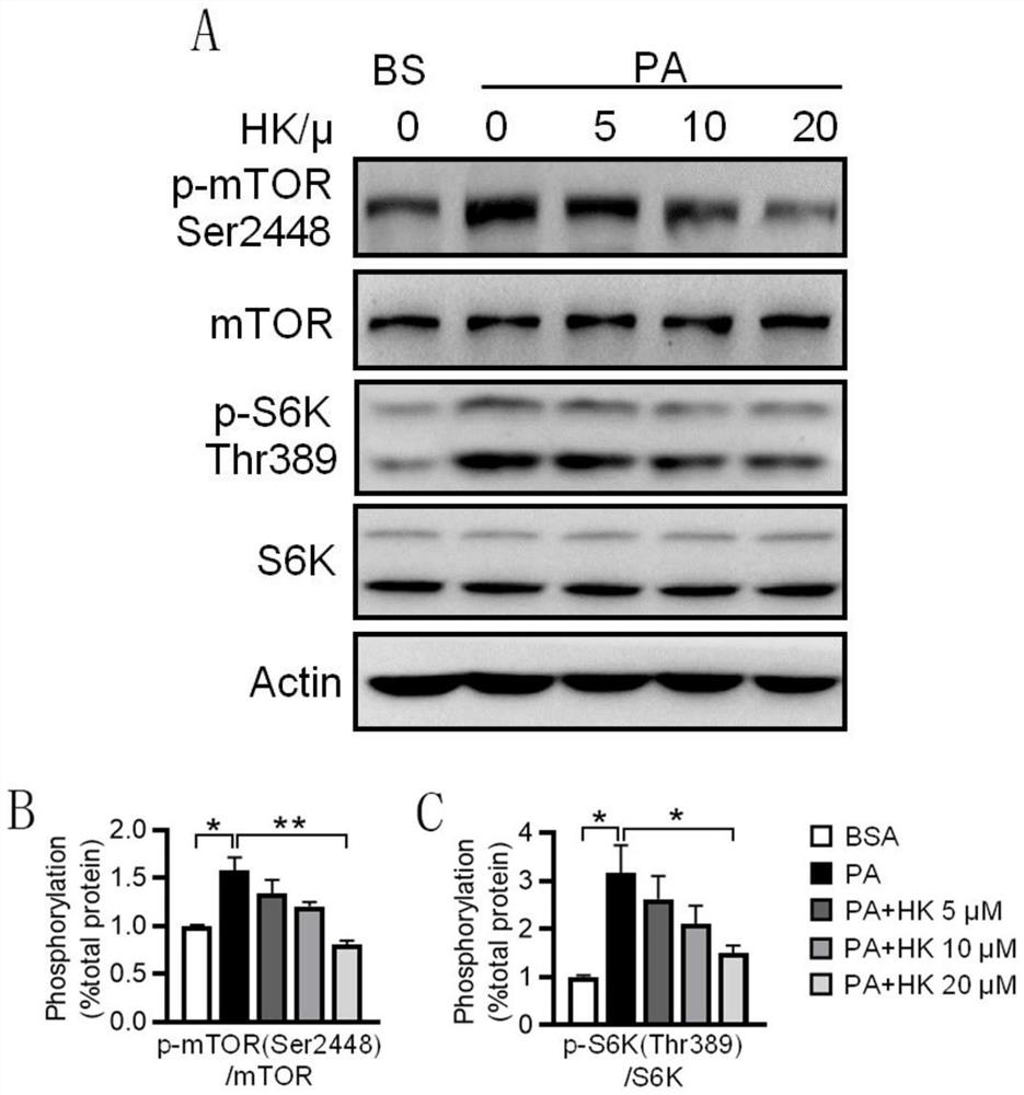 Application of Hyperforcinol K in preparation of medicine for preventing and treating non-alcoholic fatty liver disease