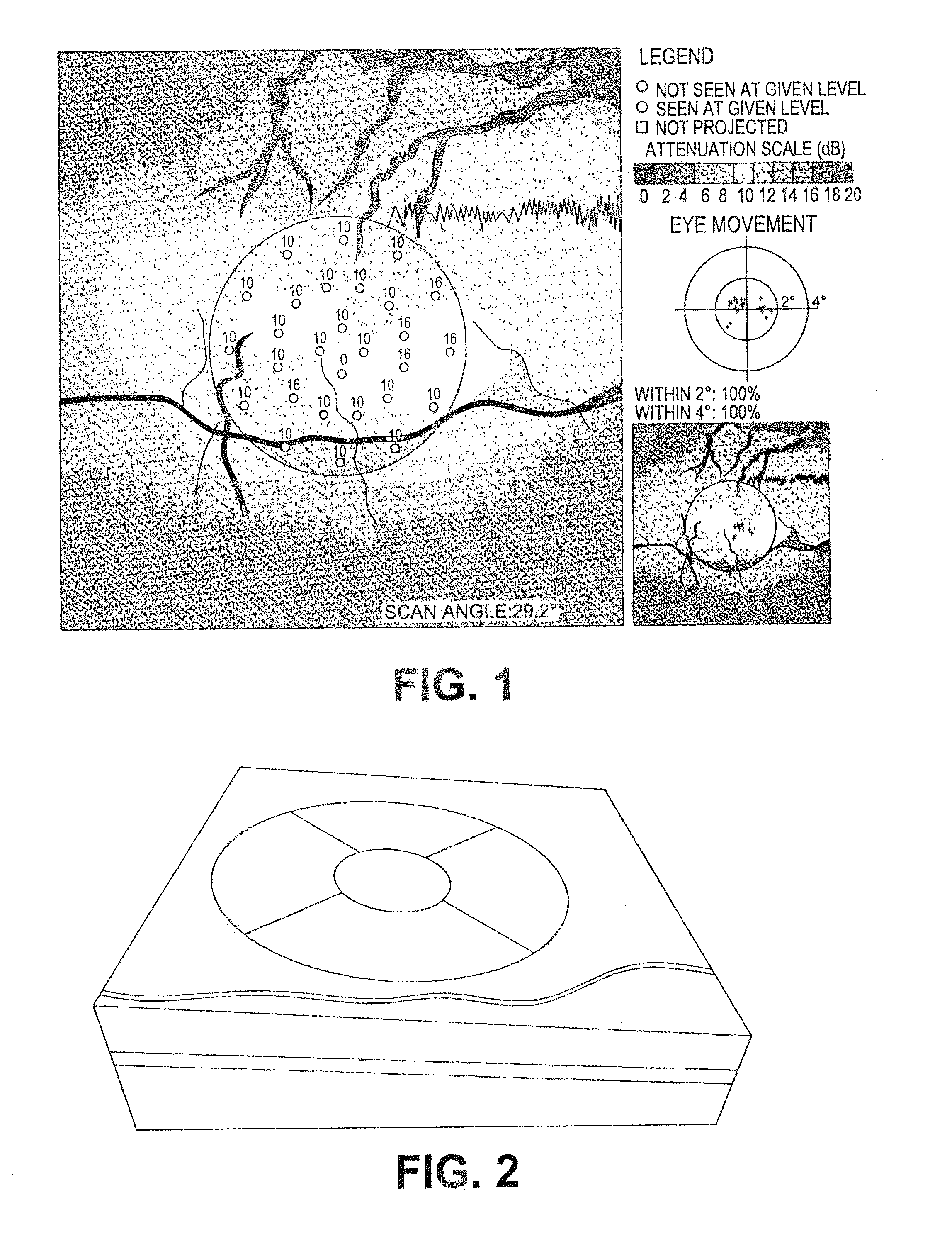 Method for performing micro-perimetry and visual acuity testing