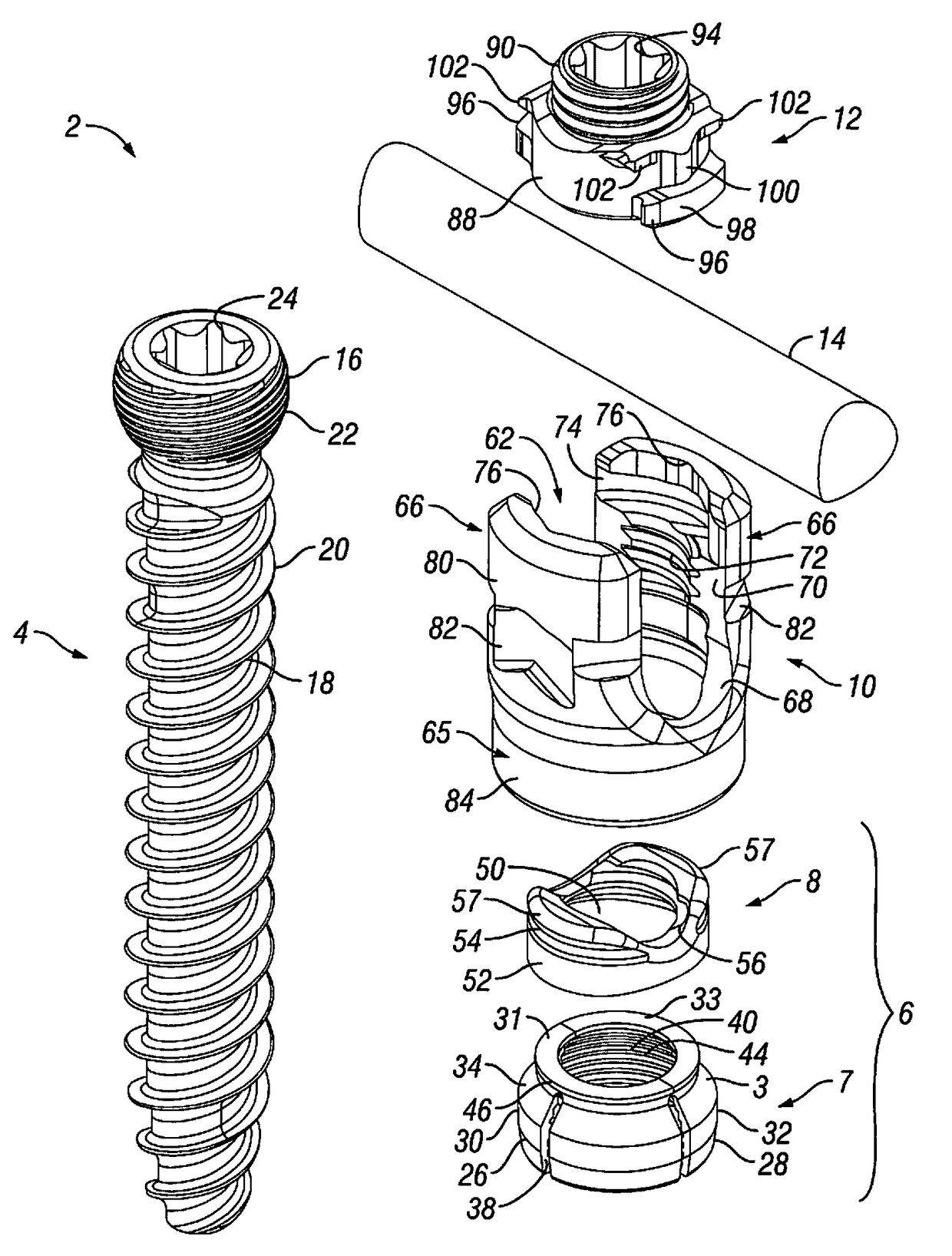 Orthopedic Fixation Devices and Methods of Installation Thereof