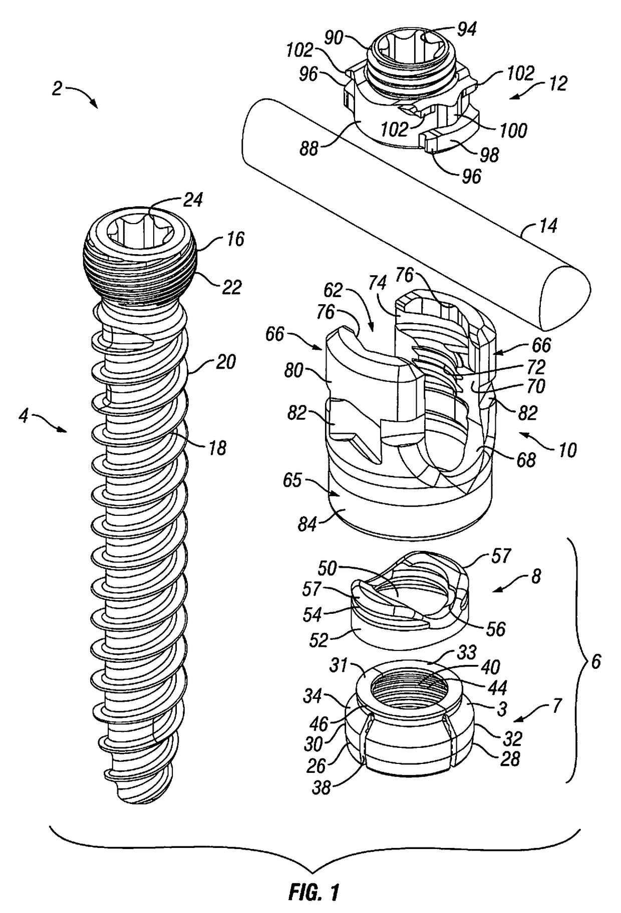 Orthopedic Fixation Devices and Methods of Installation Thereof