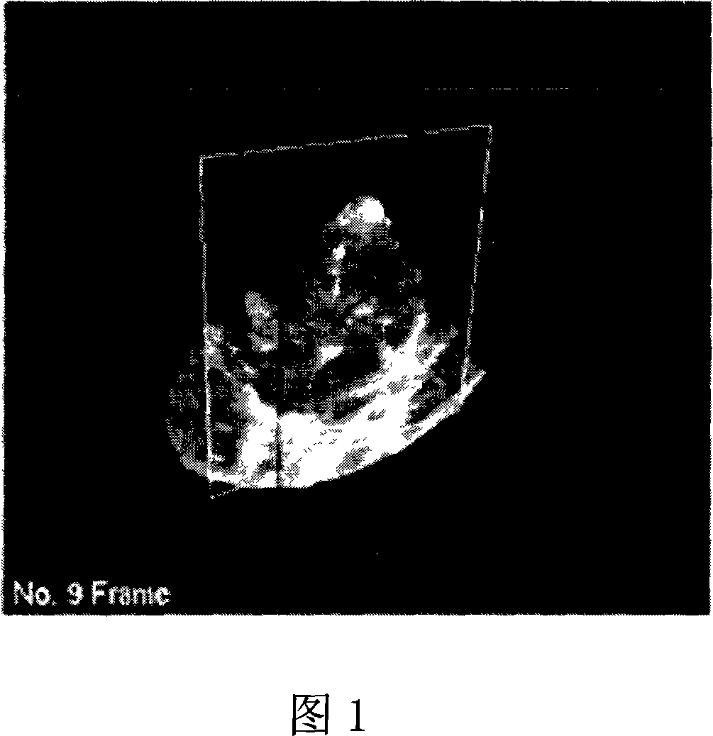 Method for computer-assisted rebuilding heart mitral annulus