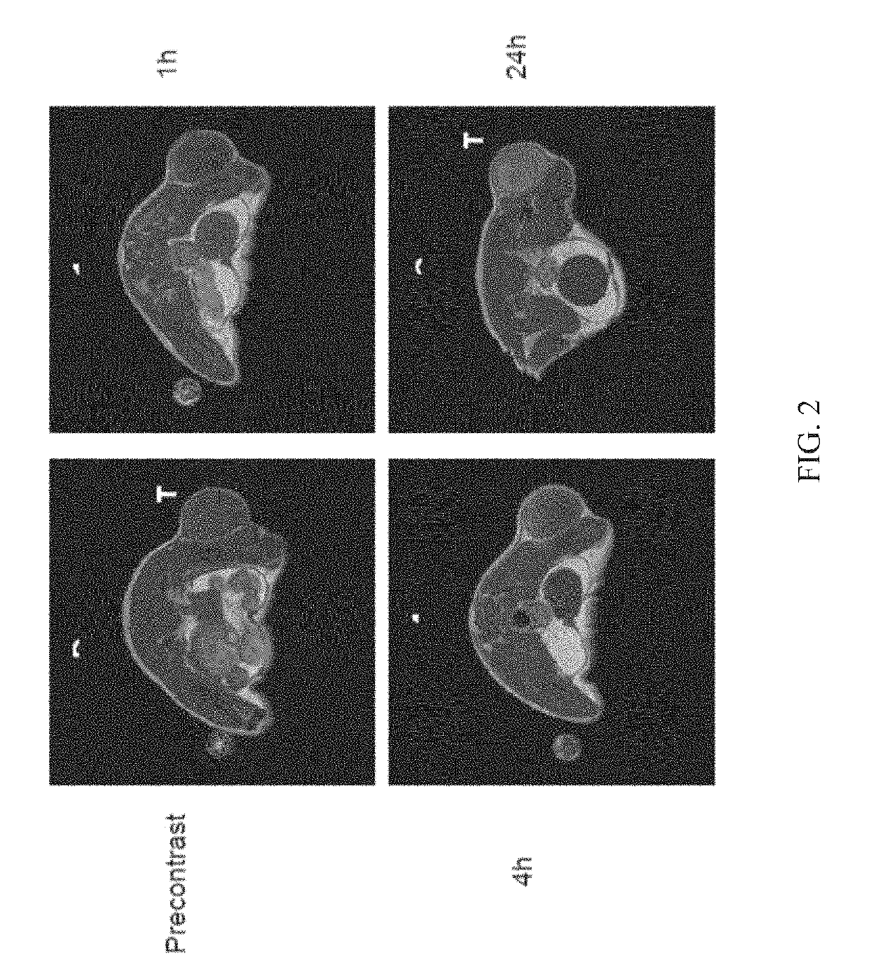 Long-lived gadolinium based tumor targeted imaging and therapy agents