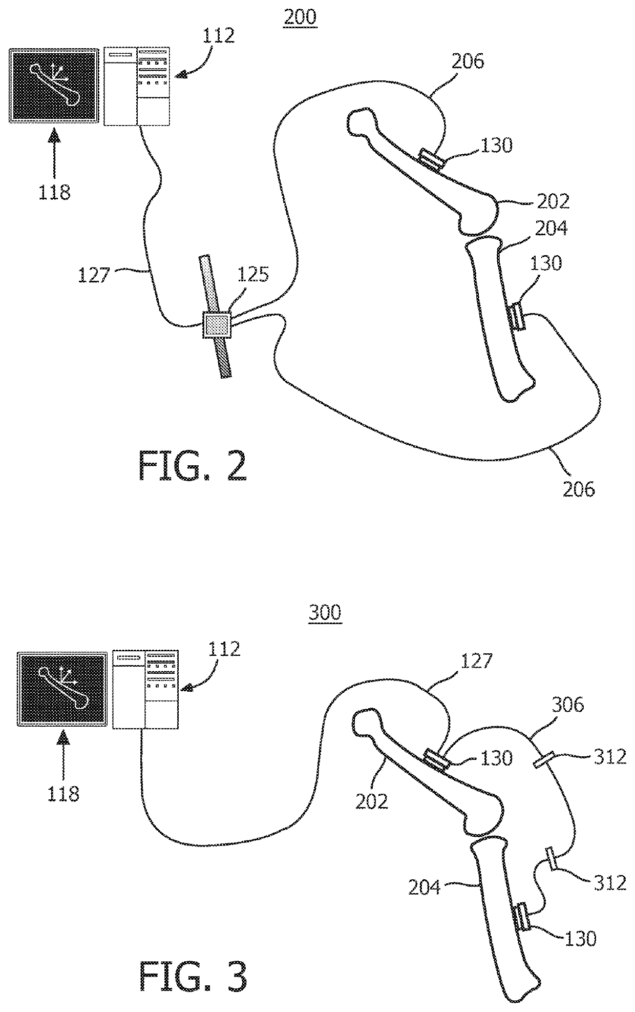 Shape sensing for orthopedic navigation