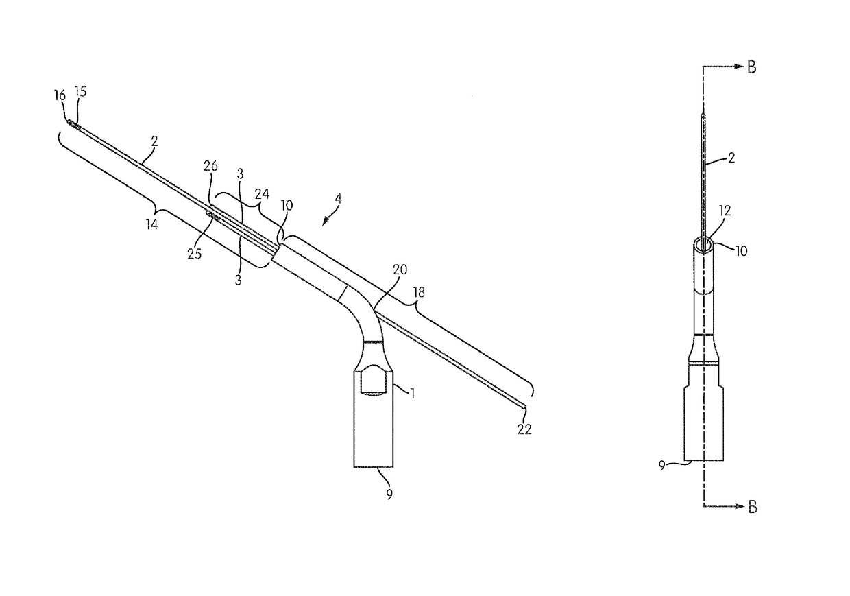 Ultrasonic tip assembly