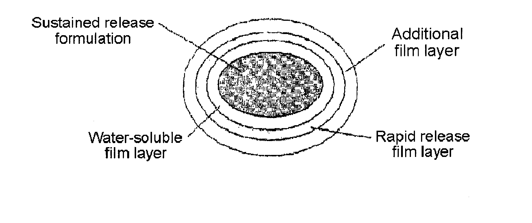 Complex Formulation Of 3-Hydroxy-3-Methyl Glutaryl Coa Reductace Inhibitor And Antihypertensive Agent, And Process For Preparing Same