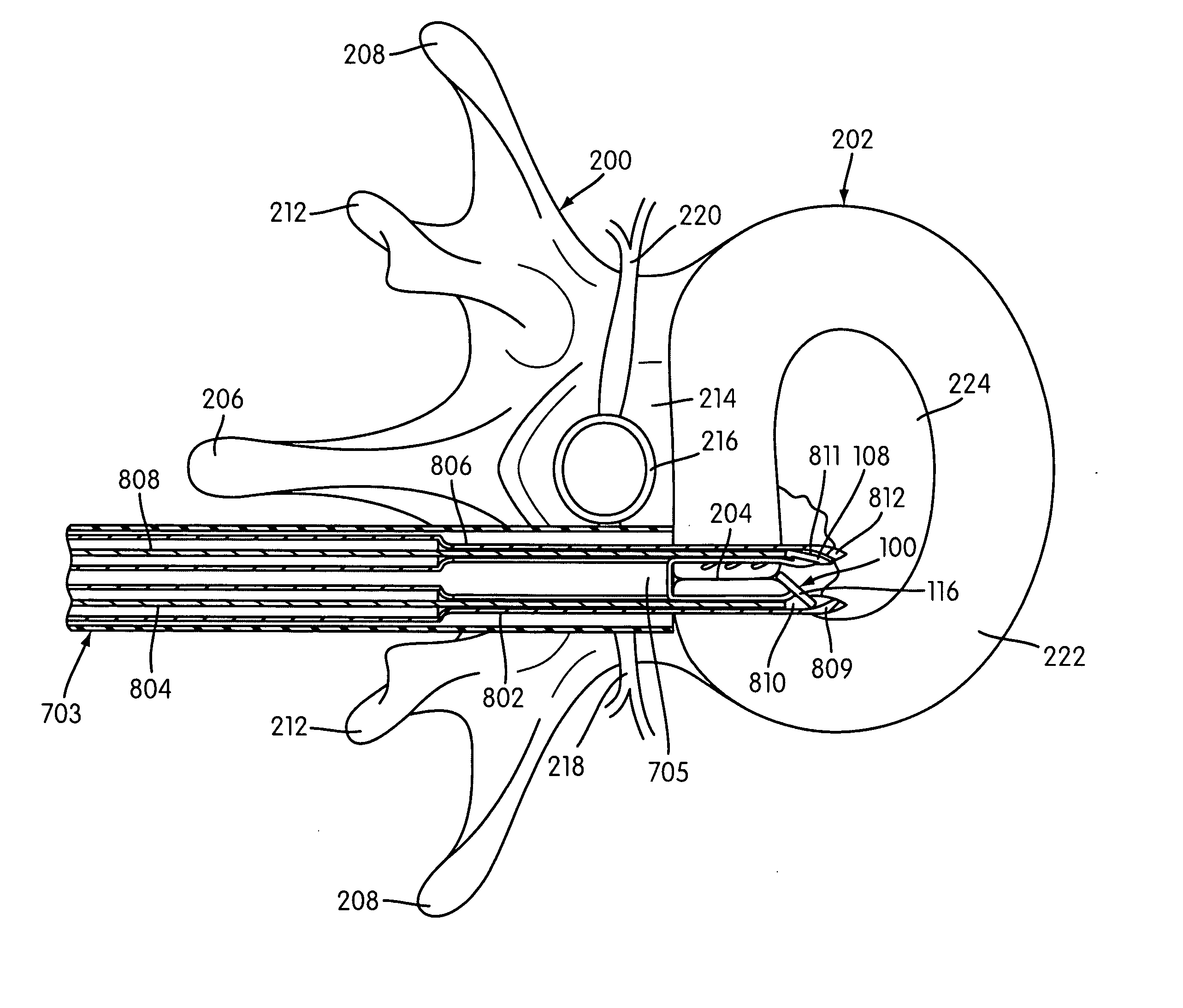 Disc annulus repair system