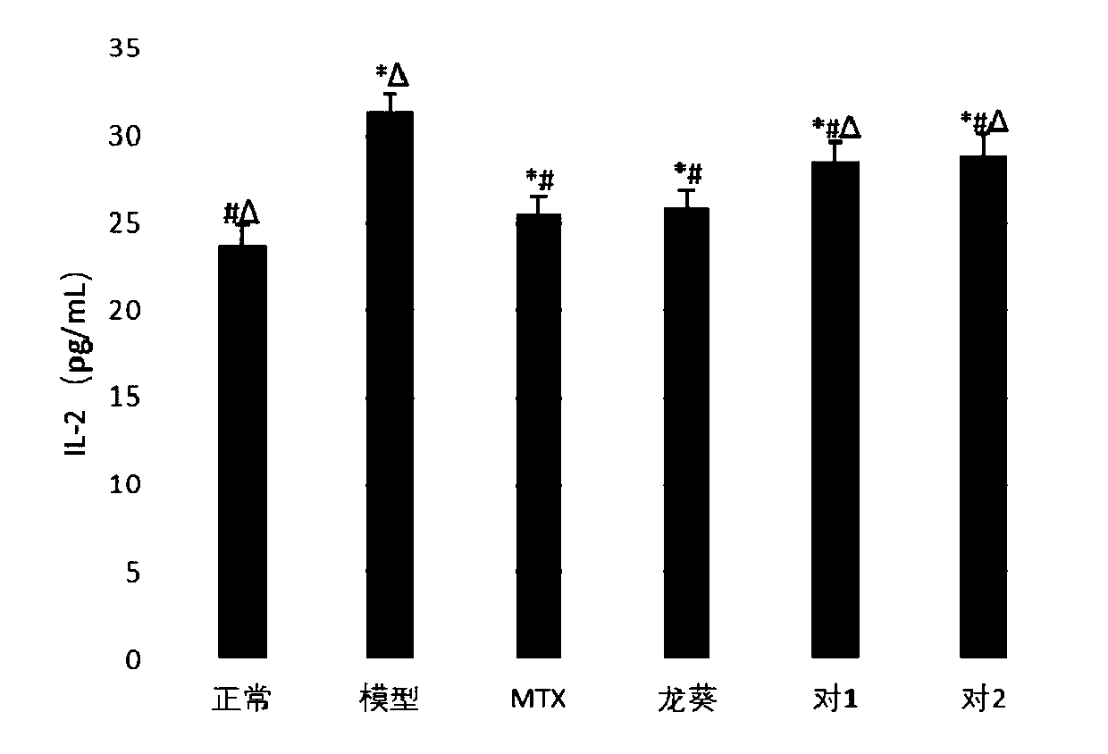 Traditional Chinese medicine composition for treating psoriasis, preparation method and application of composition