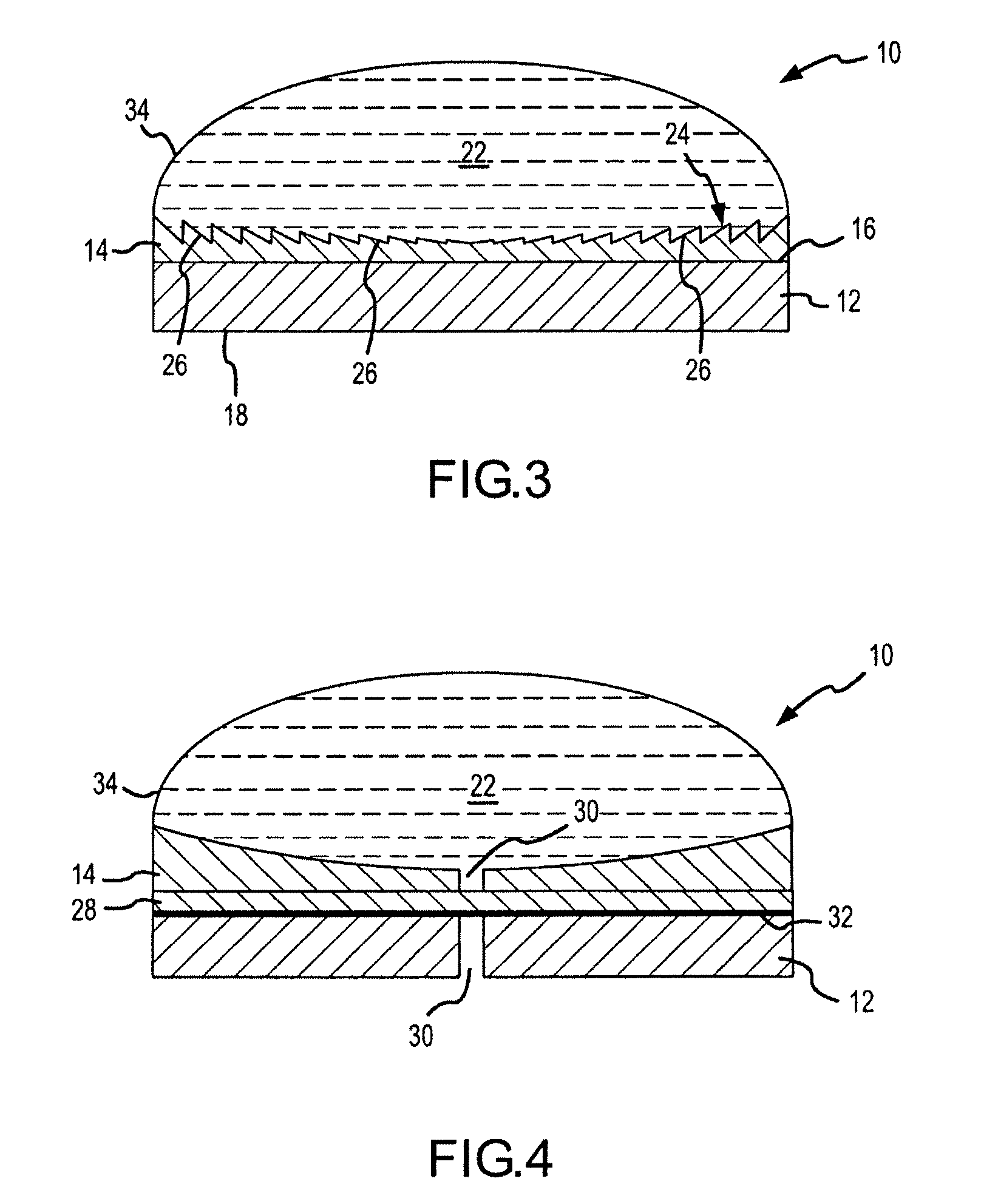 High intensity focused ultrasound transducer with accoustic lens