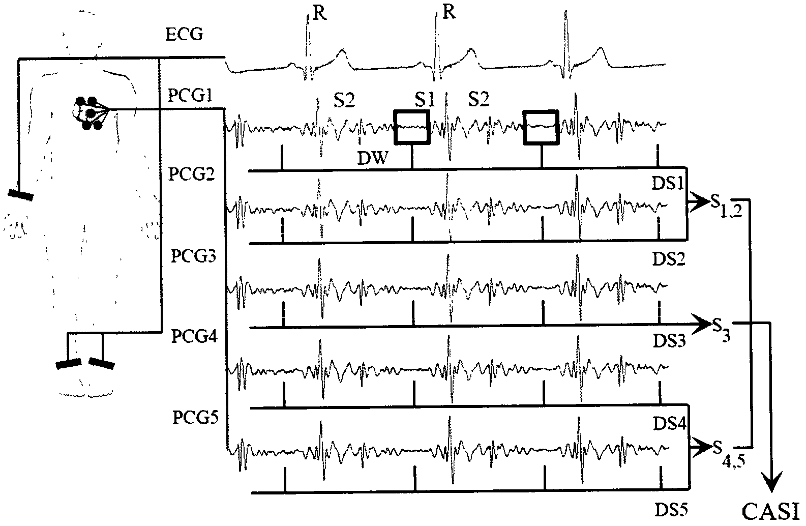 Device for detecting coronary artery stenosis