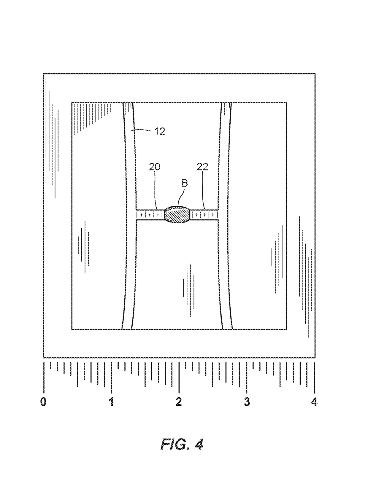 Microscale whole blood coagulation assay platform