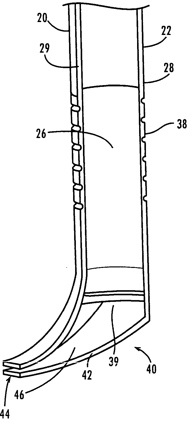 Ureteral stent