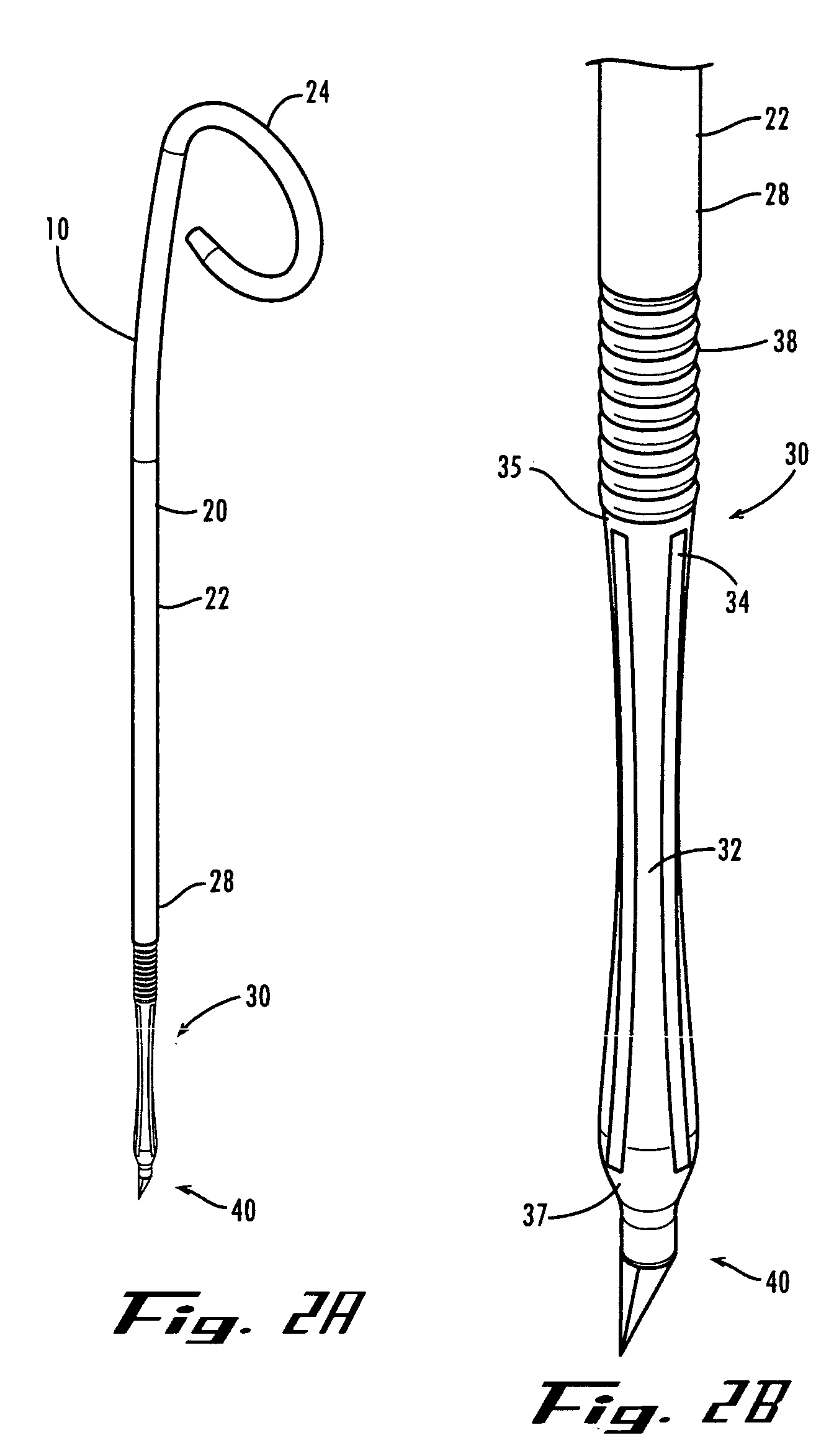 Ureteral stent