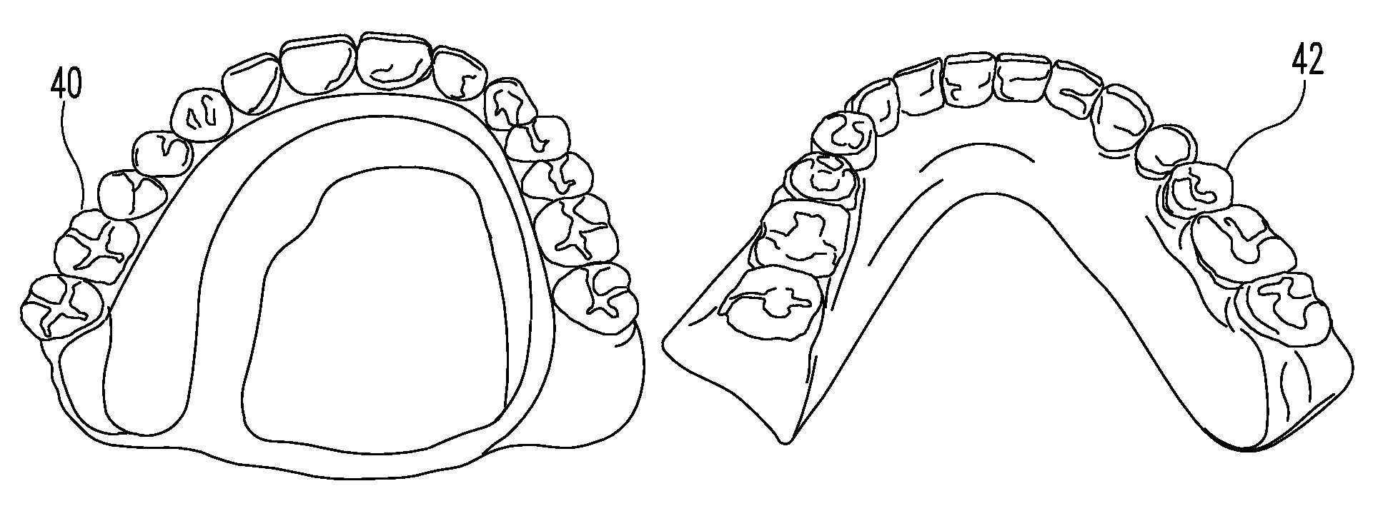 Dental prosthetic