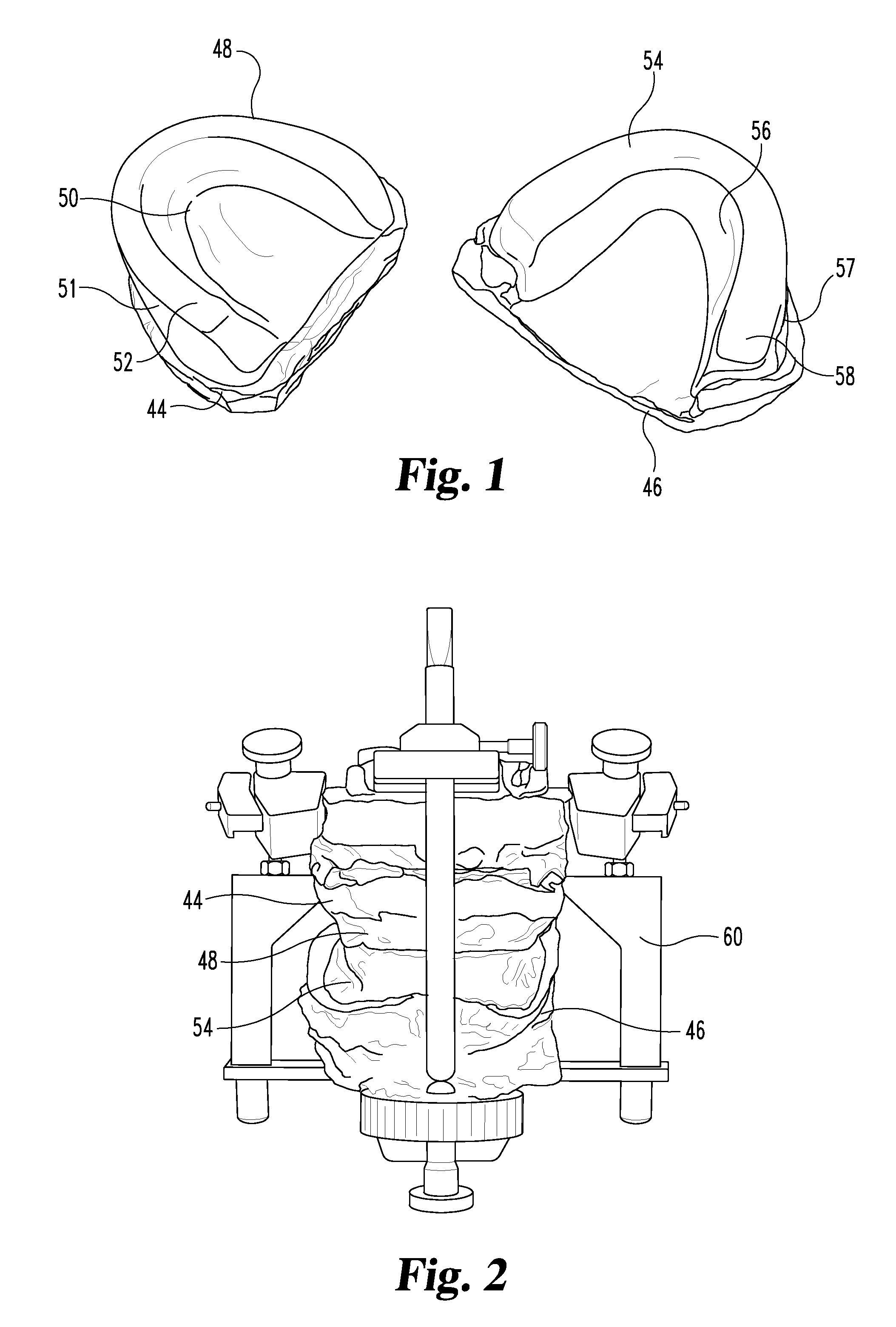 Dental prosthetic