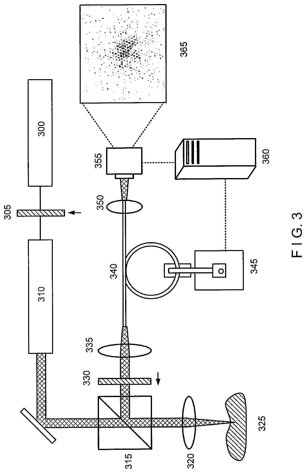 System and method providing intracoronary laser speckle imaging for the detection of vulnerable plaque