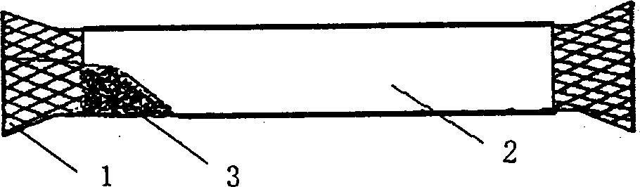 Medical internal marmem frame coated by high-molecular film for penetration therapy and its preparing process