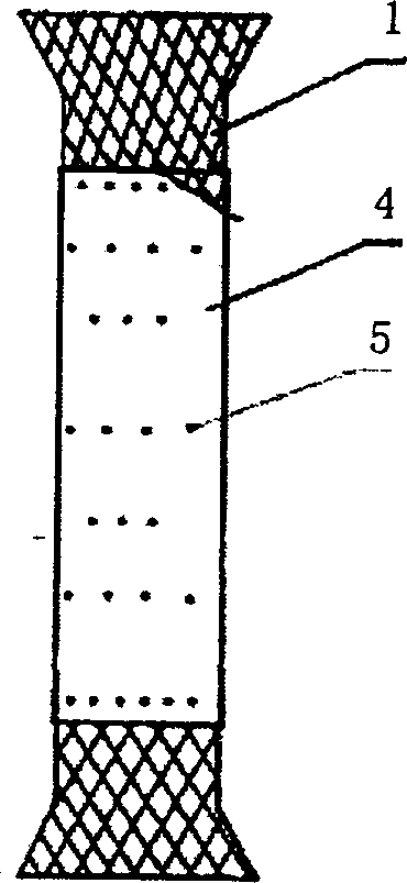 Medical internal marmem frame coated by high-molecular film for penetration therapy and its preparing process