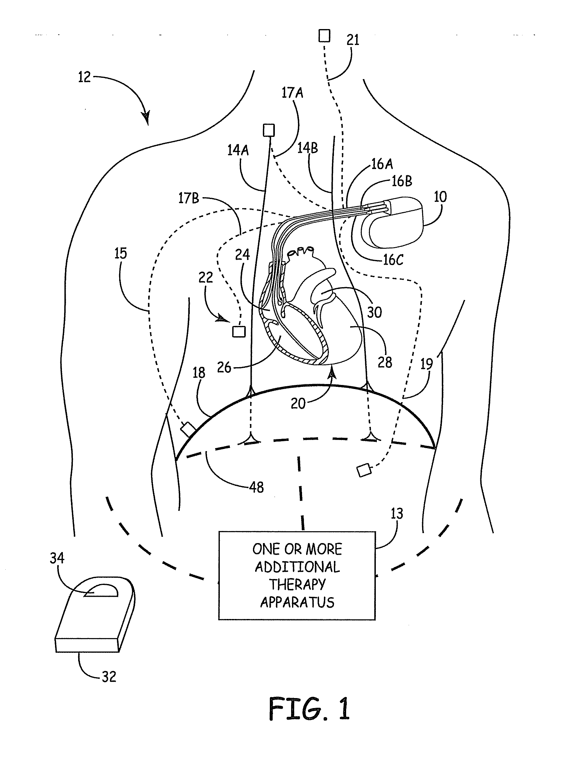 Medical device to provide breathing therapy