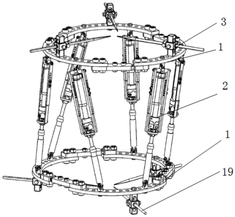 A digitally adjustable bone orthopedic external fixator with detachable motor