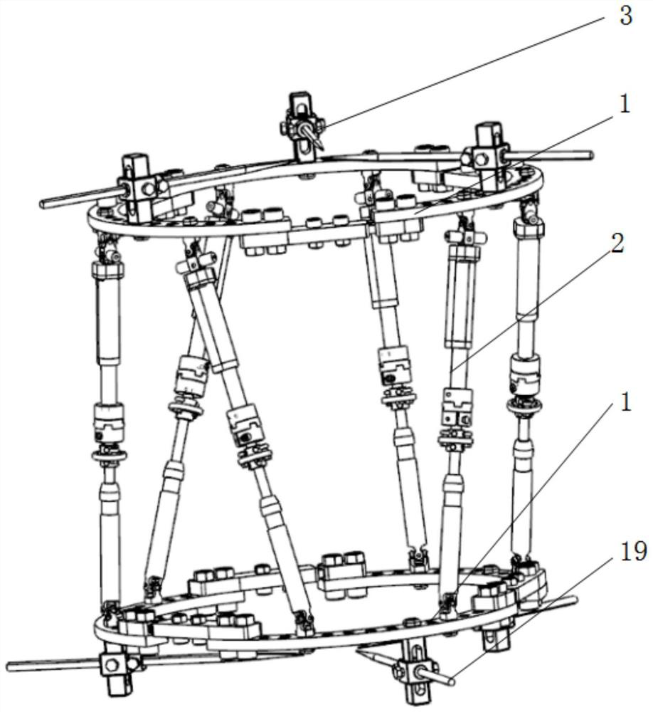 A digitally adjustable bone orthopedic external fixator with detachable motor