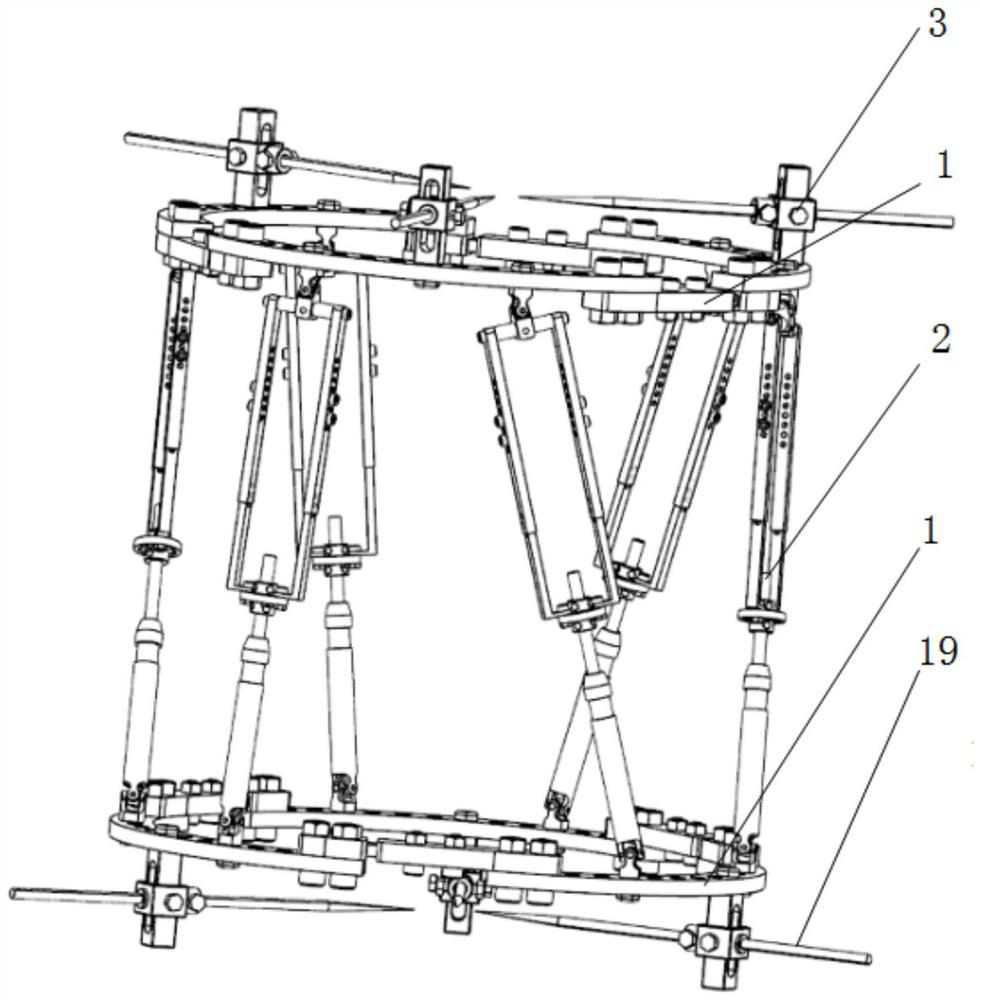 A digitally adjustable bone orthopedic external fixator with detachable motor