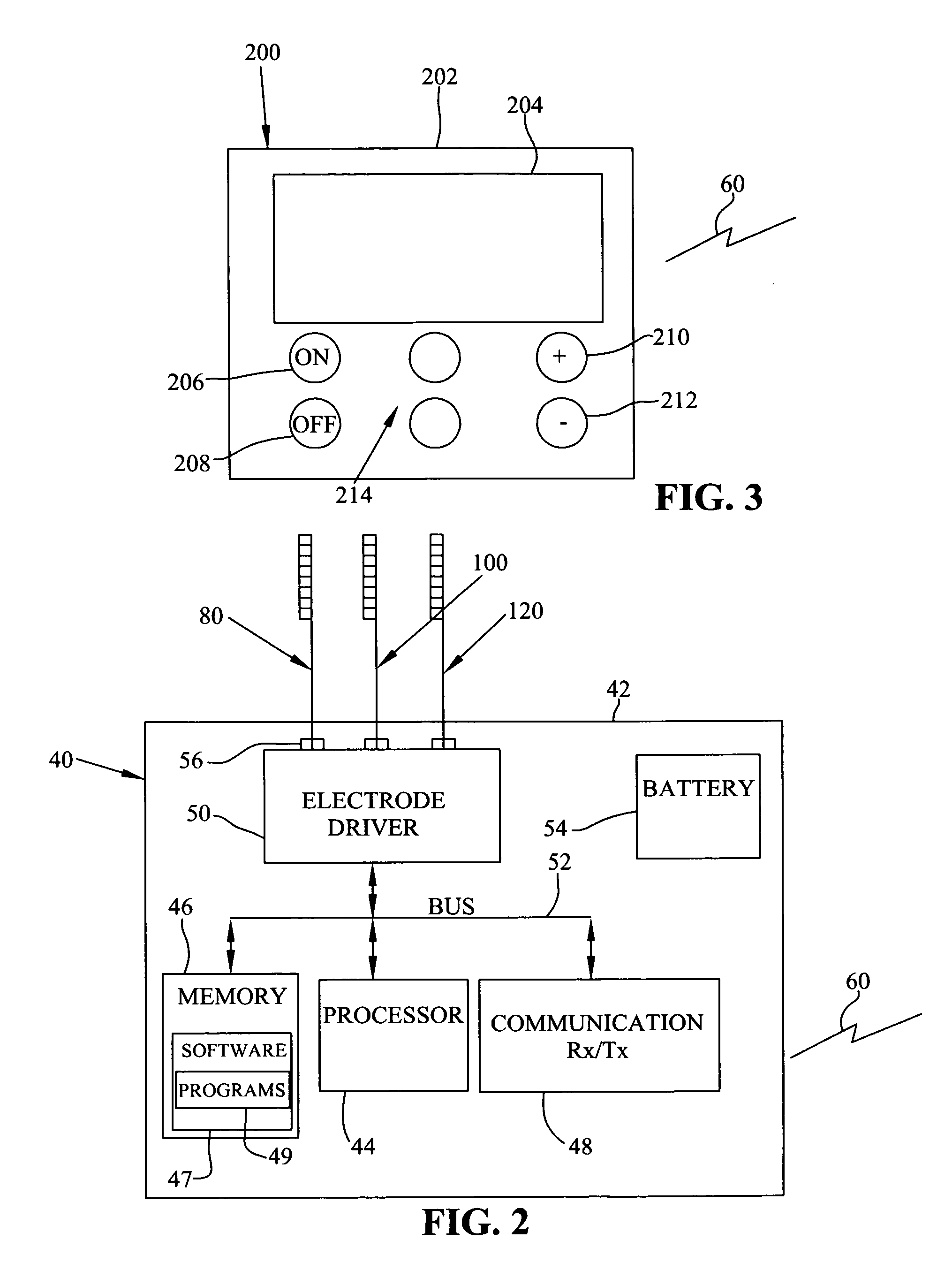 System and method for treating pain with peripheral and spinal neuromodulation