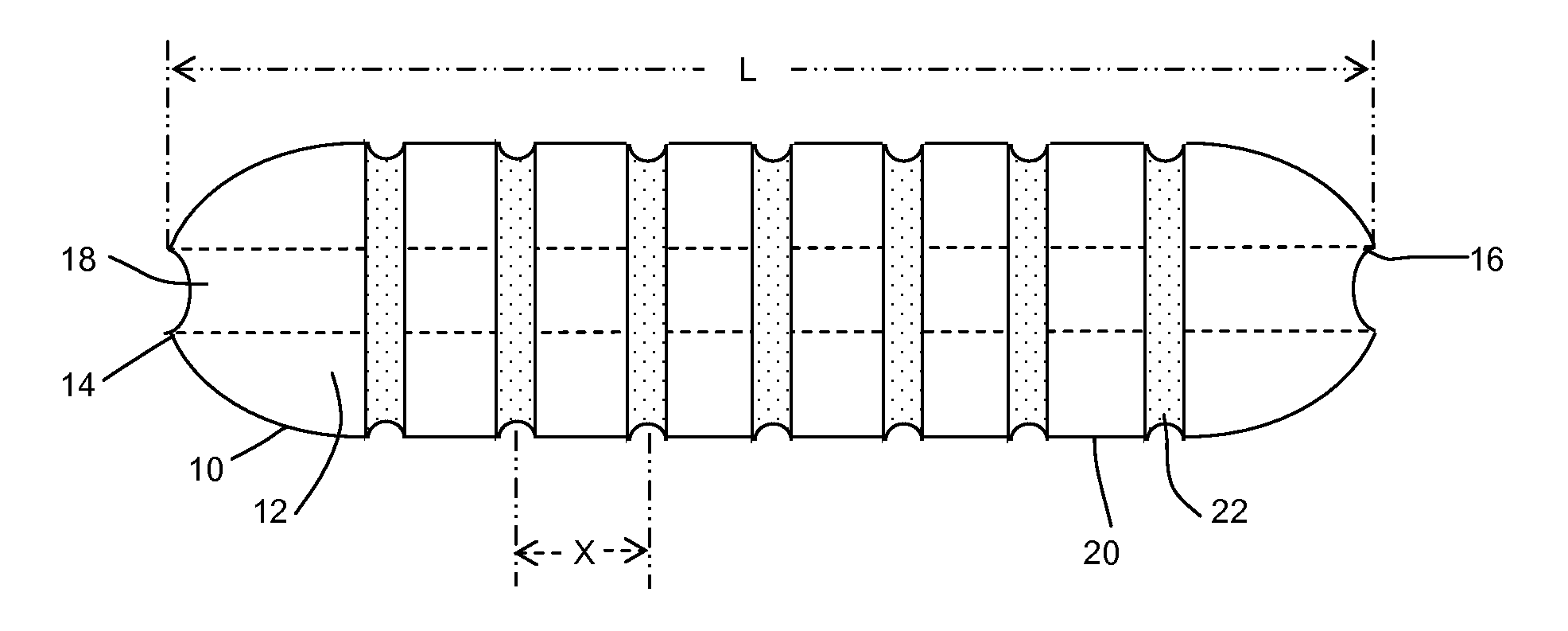 Shape memory tubular stent with grooves