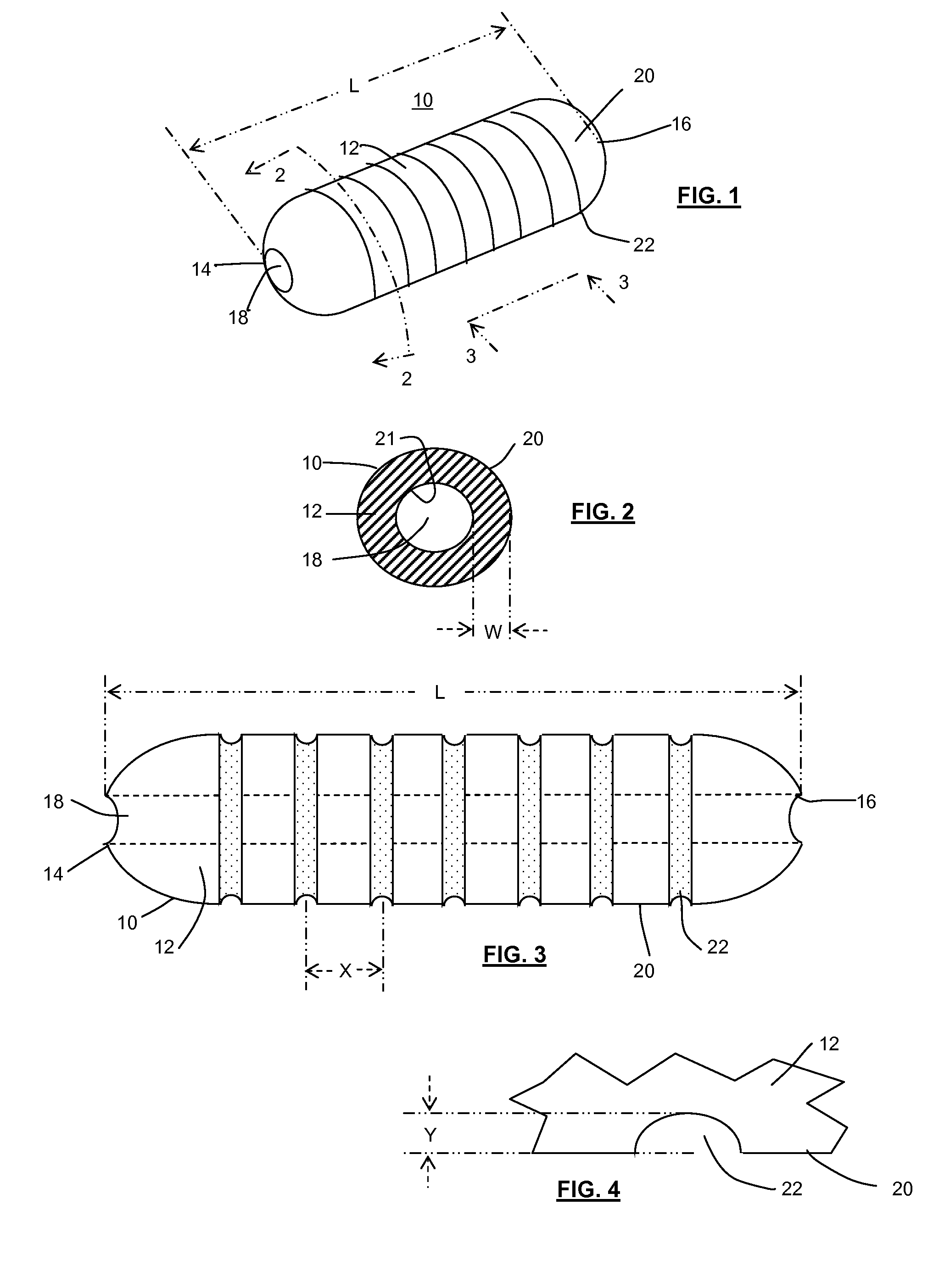 Shape memory tubular stent with grooves