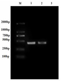 Perch rhabdovirus subunit vaccine and preparation method thereof