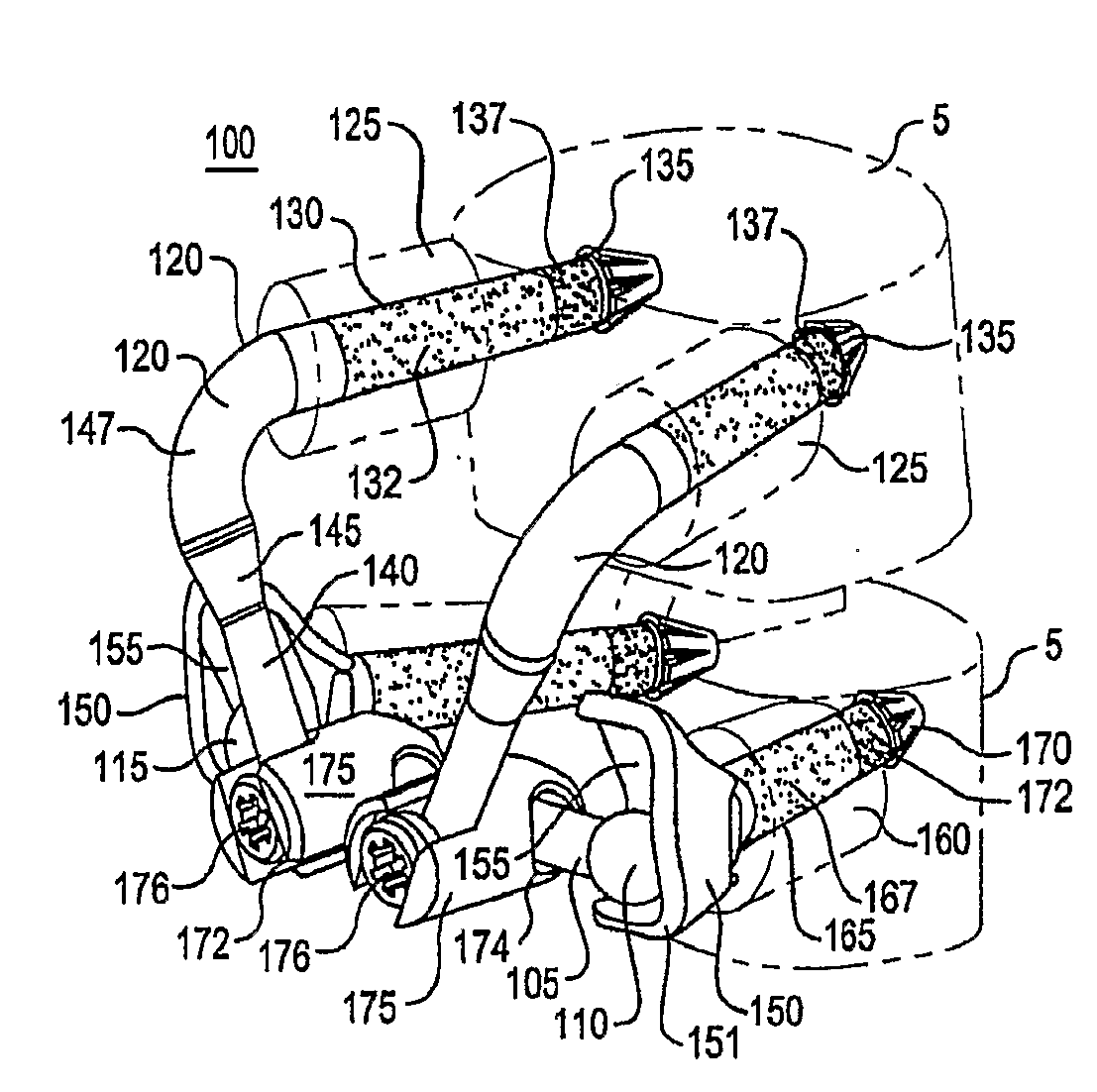 Crossbar Spinal Prosthesis Having a Modular Design and Systems for Treating Spinal Pathologies