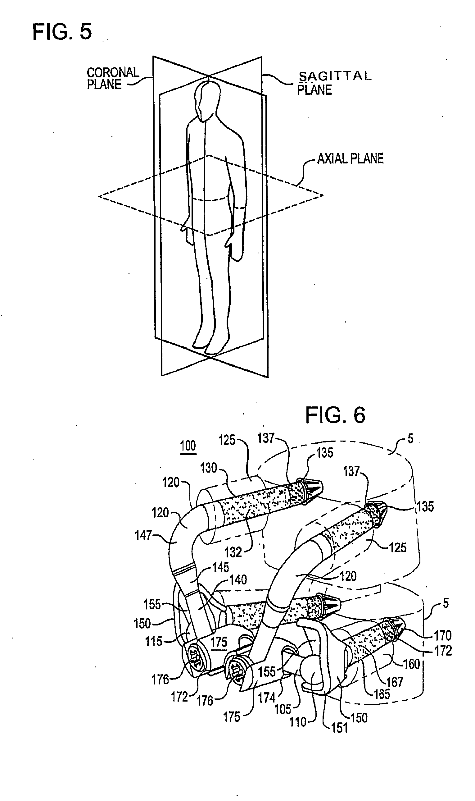 Crossbar Spinal Prosthesis Having a Modular Design and Systems for Treating Spinal Pathologies