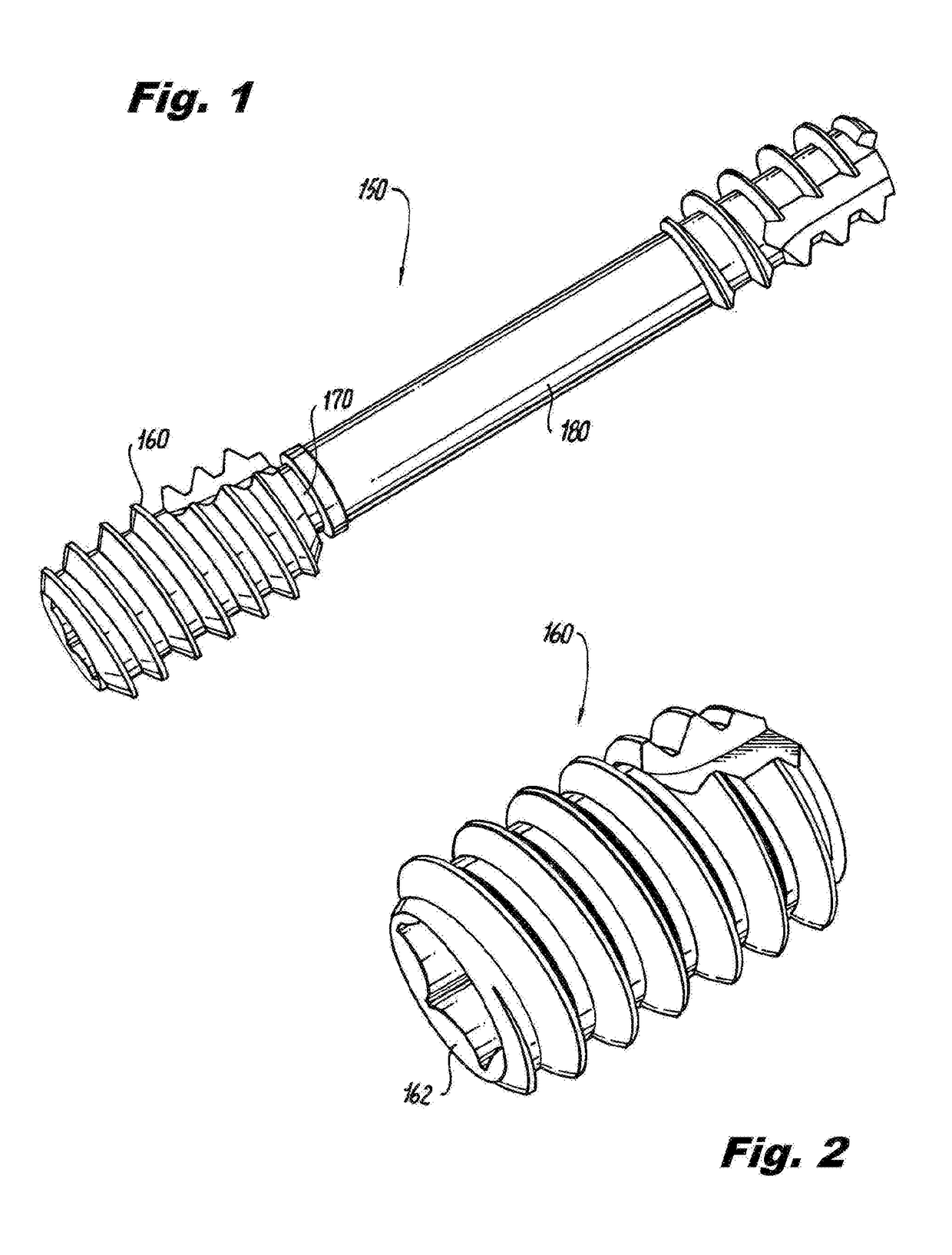 Methods, instruments and implants for scapho-lunate reconstruction